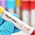 Nipah virus outbreak in India triggers Asia-wide health alert